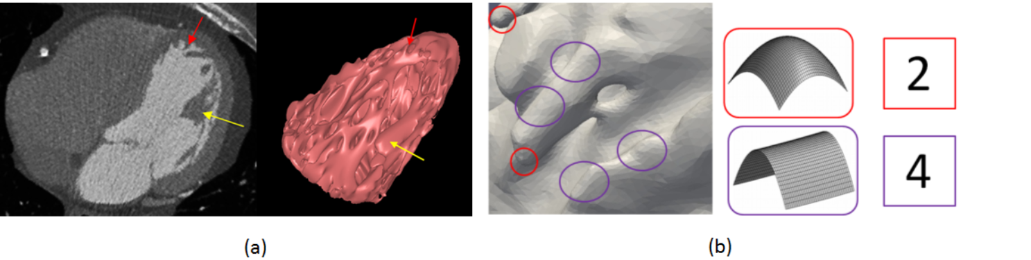 Medical Image Processing created by 'mi03niza (Kromminga, Lukas) (Kromminga, Lukas)' on uploading a picture